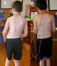 Picture5 - Milestone CDC